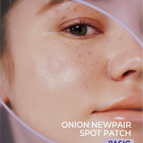 Onion Newpair Spot Patch Basic 24patches