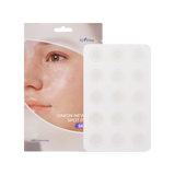 Onion Newpair Spot Patch Skin Fit 15patch